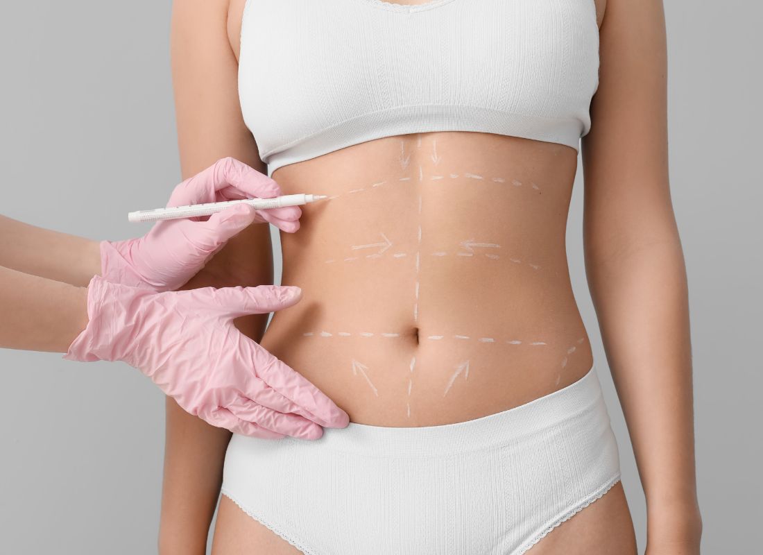 Liposuccion Abdomen Mujer Clínicas Kiharu